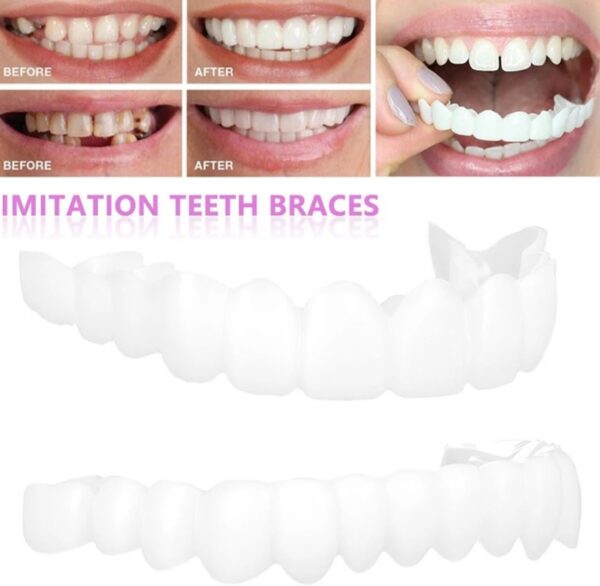 Tadipri 1 Pare Carillas Dentales Dientes Postizos Temporales De Superior E Inferior Dientes Fundas Dentales Para Cubrir Dientes Picados Con Pinzas - Image 3
