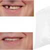 Gegong Clip en los dientes de las carillas, perlas de reparación de dientes temporales para faltar dientes rotos material de llenado dental dental, cemento de dientes (100g)