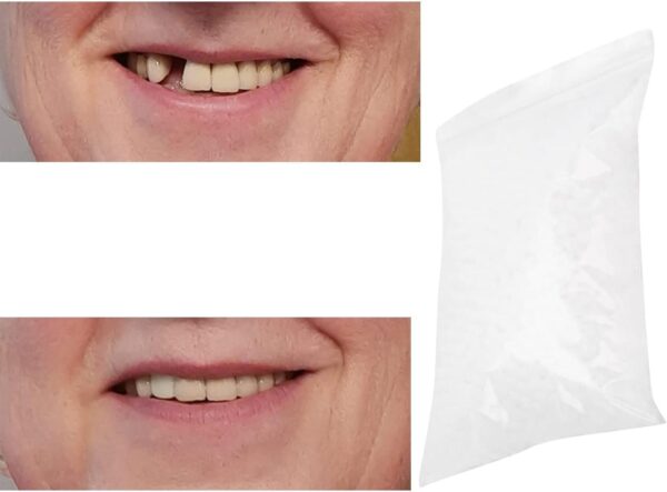 Gegong Clip en los dientes de las carillas, perlas de reparación de dientes temporales para faltar dientes rotos material de llenado dental dental, cemento de dientes (100g)