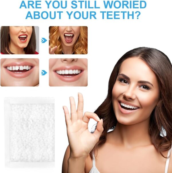ACWOO Perla Dental, Dientes falsos moldeables temporales, Reemplazos de Dientes Temporales, 50g Perlas de Reparación de Dientes Temporales para Dientes Rotos Faltantes, Material de Relleno de Dientes - Image 6