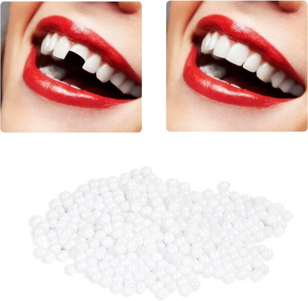ACWOO Perla Dental, Dientes falsos moldeables temporales, Reemplazos de Dientes Temporales, 50g Perlas de Reparación de Dientes Temporales para Dientes Rotos Faltantes, Material de Relleno de Dientes - Image 8