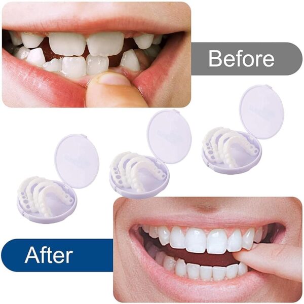 Dientes de Carillas Cosméticas, Dentaduras Postizas Instantáneas, Dentaduras Temporales, 5 Pares Carillas Dentales, Carillas Falsa, Postizos de Superior E Inferior Dientes, Cepillos Interdentales - Image 8