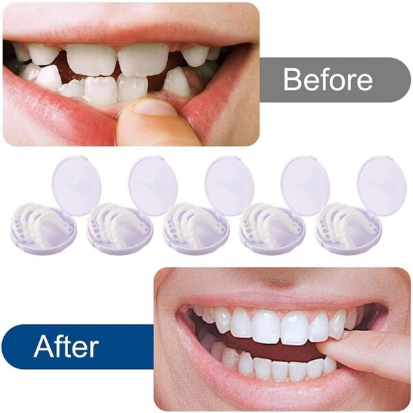 Dientes de Carillas Cosméticas, Dentaduras Postizas Instantáneas, Dentaduras Temporales, 5 Pares Carillas Dentales, Carillas Falsa, Postizos de Superior E Inferior Dientes, Cepillos Interdentales - Image 3