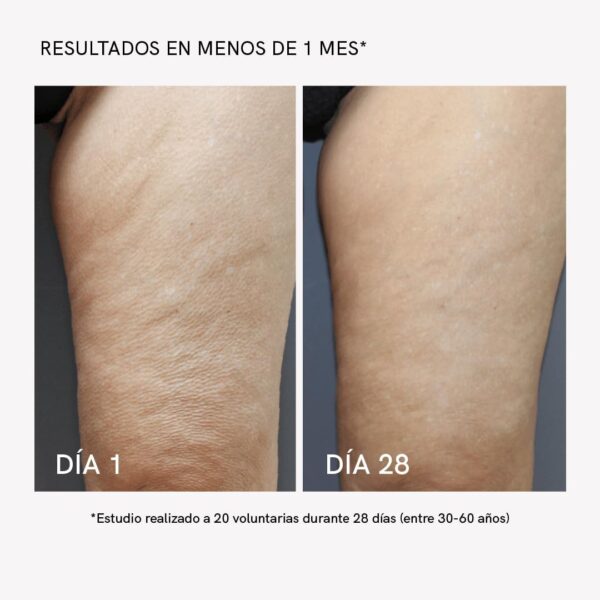MASDERM | Gel-Crema Corporal Radiofrecuencia Reafirmante Hidratante 1000 ml | Profesional | Mujer | Cavitación | Ultrasonidos | Luz LED | - Image 4