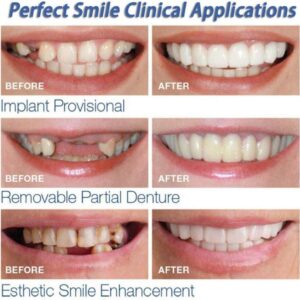 ZLSN 5 Piezas Dientes Dentadura Cosmética de los Dientes Sonrisa Temporal Superior Etiqueta Adhesiva cosmética de la dentadura Dientes Comfort Fit