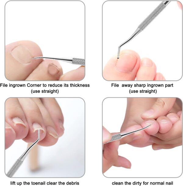 Cuchillo De Pedicura Juego De Cuchillos Pedicura Profesional Cuchillas Para Callos Bisturi Cuchilla Pies Bisturi Podologo Cortacallos Acero Inoxidable Cortacallos Pies Corta Callos Pies Cuchillo - Image 3