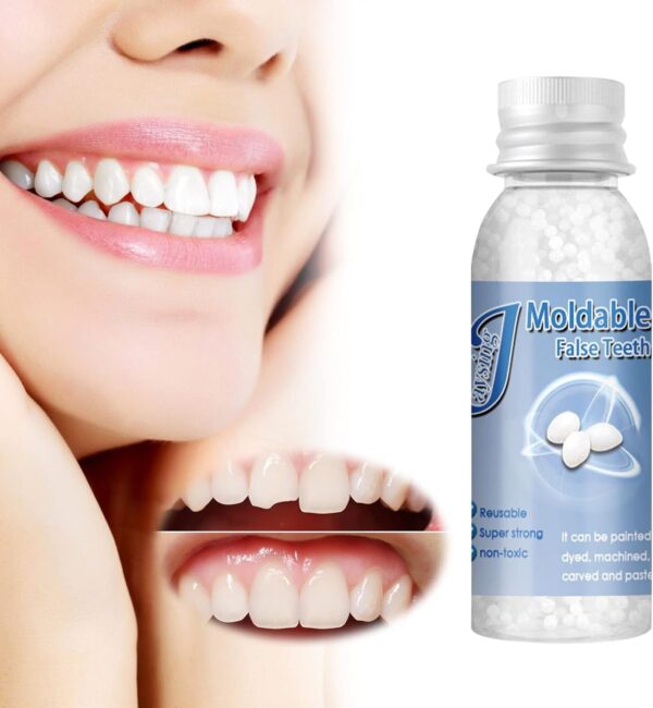 Kit de Reparación de Dientes Temporal, Reemplazos de Dientes Temporales, Dientes falsos moldeables temporales para reparar el relleno del diente roto faltante, Ajuste Instantáneo y Sonrisa Segura,10ml