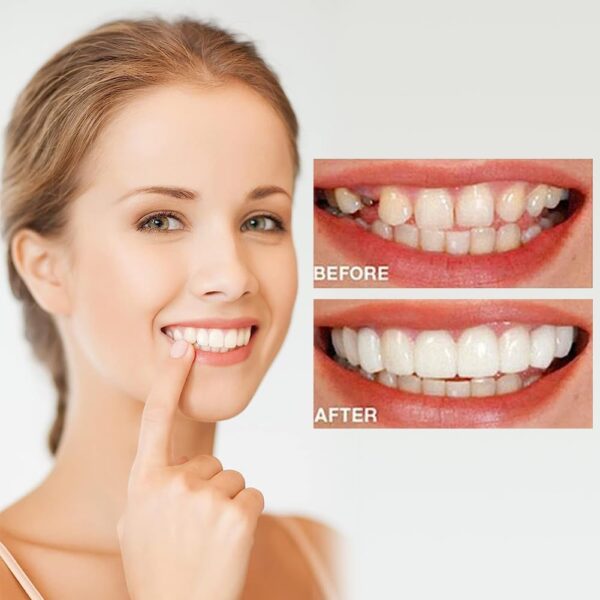 Dientes de Carillas Cosméticas, Dentaduras Postizas Instantáneas, Dentaduras Temporales, 5 Pares Carillas Dentales, Carillas Falsa, Postizos de Superior E Inferior Dientes, Cepillos Interdentales - Image 5