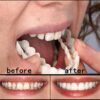 ZLSN 5 Piezas Dientes Dentadura Cosmética de los Dientes Sonrisa Temporal Superior Etiqueta Adhesiva cosmética de la dentadura Dientes Comfort Fit - Image 6