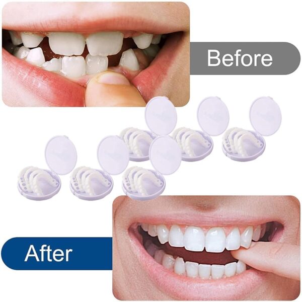 Dientes de Carillas Cosméticas, Dentaduras Postizas Instantáneas, Dentaduras Temporales, 6 Pares Carillas Dentales, Carillas Falsa, Postizos de Superior E Inferior Dientes, Cepillos Interdentales - Image 3