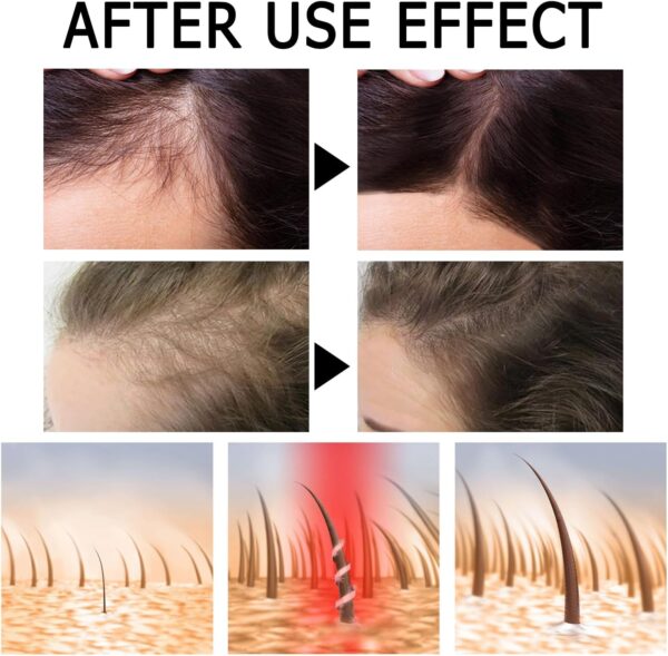 Ampollas Fortalecedoras Para El Cabello, Suero Para El Crecimiento Del Cabello, Ampollas De Tratamiento Acondicionador Profundo, Suero Para Un Cabello Más Grueso, Largo, Voluminoso Y Saludable - Image 5