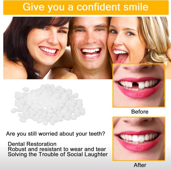 lankai Dientes Postizos Temporales, Perlas de Reparación Dental Temporal, Restauración Dental, Kit de Reparación de Dientes, Dientes Falsos Moldeables, para Prótesis Provisionales, Dientes rotos(100g) - Image 2