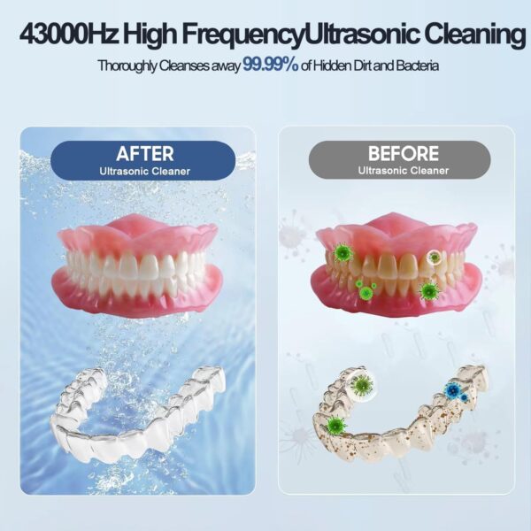 Limpiador Ultrasonidos Dental Limpieza, 43000Hz Limpiador de Dientes Máquina limpiadora ultrasónica Para Dentaduras Postizas, Alineadores, Retenedores, Cabezas de Cepillos de Dientes (Black) - Image 2