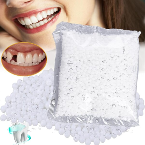 lankai Dientes Postizos Temporales, Perlas de Reparación Dental Temporal, Restauración Dental, Kit de Reparación de Dientes, Dientes Falsos Moldeables, para Prótesis Provisionales, Dientes rotos(100g)