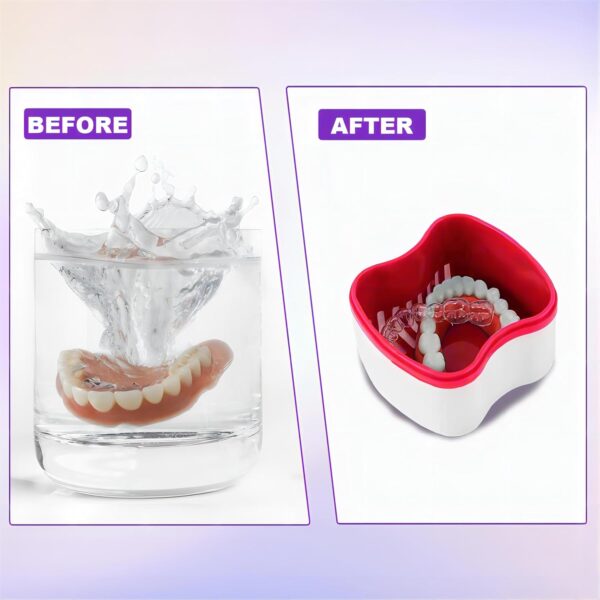 2 Cajas para Dentaduras Postizas Ortodoncia con 2 Cepillos de Dientes, Estuches de Baño para Dentaduras de Plástico, Recipiente de Dientes Postizos, Tazas de Limpieza Dentaduras con Cesta de Enjuague - Image 4
