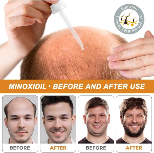 Suero de crecimiento capilar con biotina-Kit de crecimiento de barba-Cuidado del cabello para un cabello y barba saludables-Kit de cuidado para el crecimiento de los hombres-60ML - Image 3