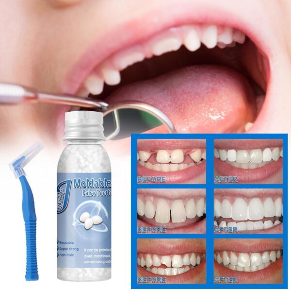 Kit de Dientes,Dientes de Carillas Cosméticas, Dentaduras Postizas Instantáneas,Dentaduras Temporales,Carillas Dentales, Carillas Falsa, Postizos de Superior E Inferior Dientes,Cepillos Interdentales - Image 2