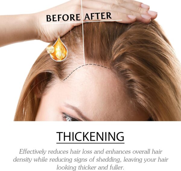 Ampollas Fortalecedoras Para El Cabello, Suero Para El Crecimiento Del Cabello, Ampollas De Tratamiento Acondicionador Profundo, Suero Para Un Cabello Más Grueso, Largo, Voluminoso Y Saludable - Image 7