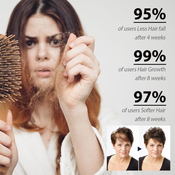 Ampollas Fortalecedoras Para El Cabello, Suero Para El Crecimiento Del Cabello, Ampollas De Tratamiento Acondicionador Profundo, Suero Para Un Cabello Más Grueso, Largo, Voluminoso Y Saludable - Image 6