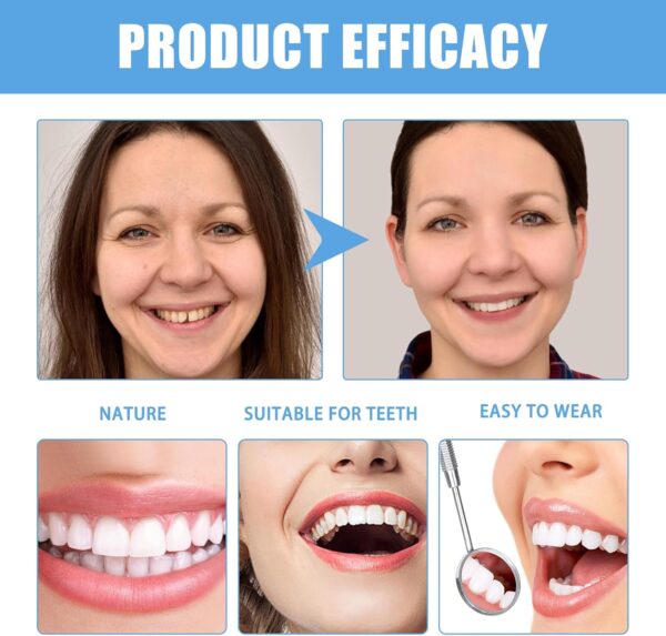 Juego de 2 Piezas Dentadura De Silicona Dentaduras Postizas Ajustables Dientes Postizos Temporales Carillas Dentales Natural en Forma y Cómodo Para Hombres y Mujeres - Image 3