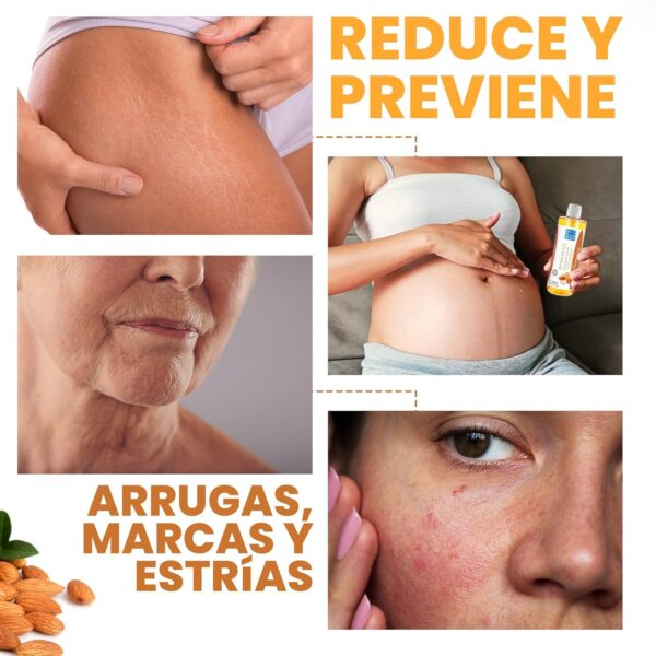 Aceite de Almendras, Prensado en frio, 100% Puro y Natural, Cultivo Ecologico, Aceite Corporal Hidratante, Anti Estrias, Embarazo, Pelo, Bebe, Antiestrias, Reafirmante, Masaje Senos, 2000 ml - Image 6