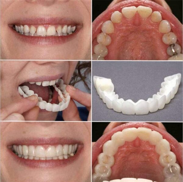 Ulat 2 Pares (dentadura Superior e Inferior) Dentadura Superior e Inferior Instant Fit Flex Cosmetic Teeth Dentadura Dental Top carilla cosmética